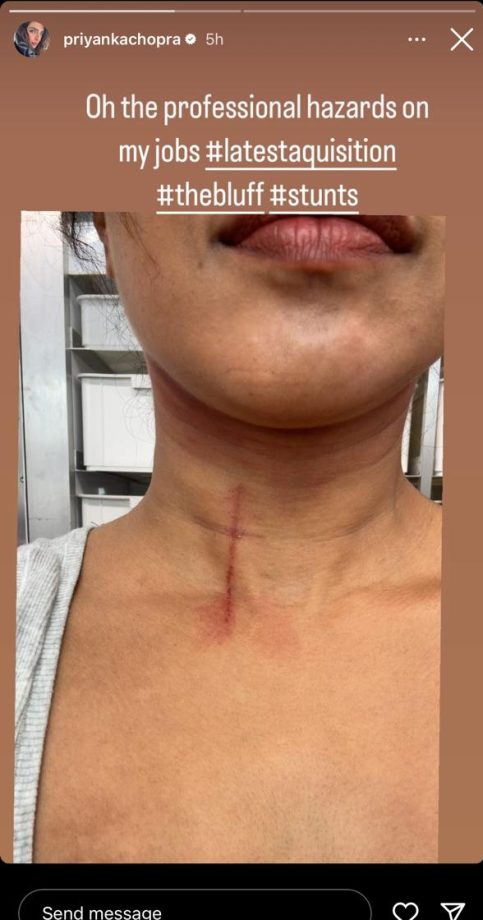 1. Priyanka Chopra Suffers Throat Injury While Filming 'The Bluff,' Checkout Photos! 901266