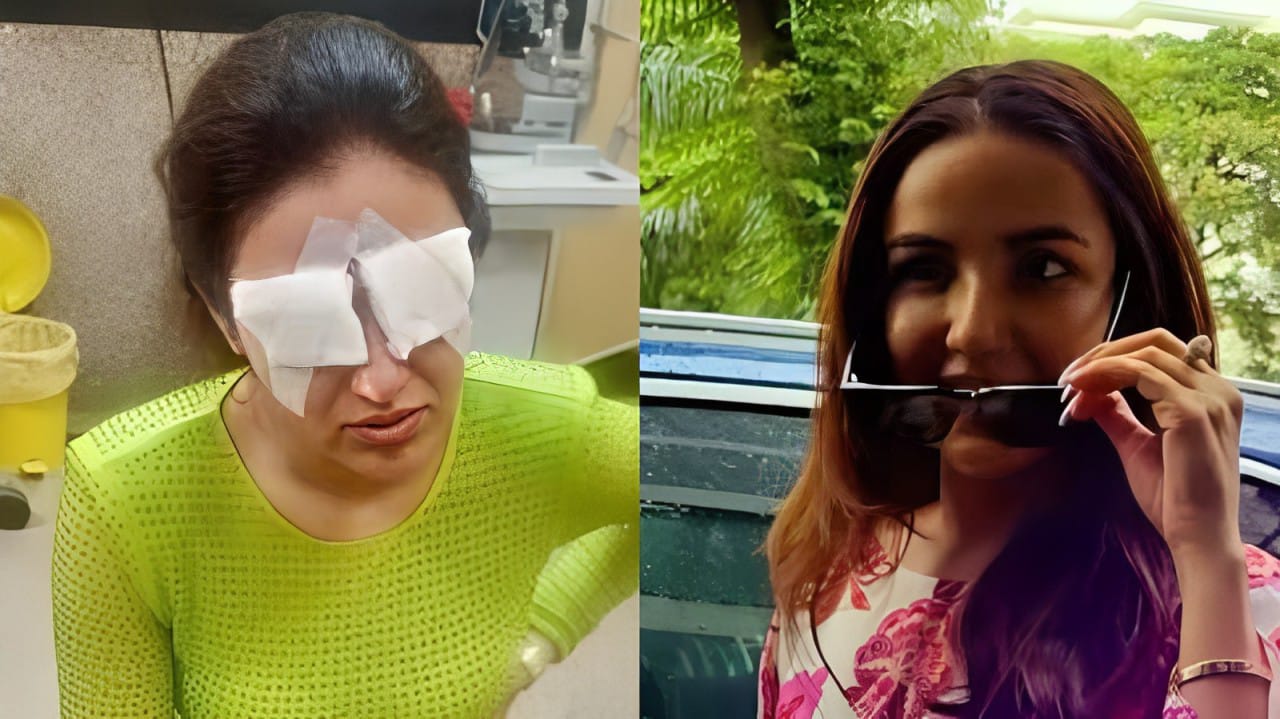 Jasmin Bhasin gives an update after suffering corneal damage & wearing eye patches on both eyes 911473