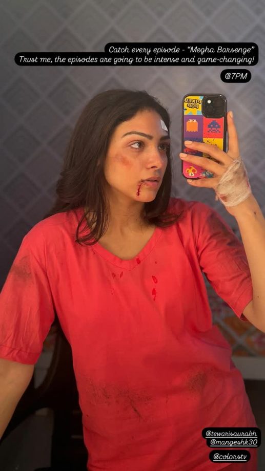 Megha Barsenge's Neha Rana Posts 'Bruised' Picture On Social Media, Asks Fans To Look Forward To Intense Drama In Show 917604