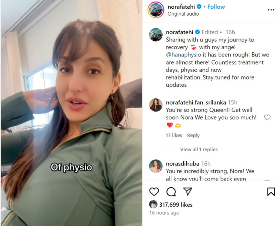 Nora Fatehi shares her painful physio journey after leg injury 919272