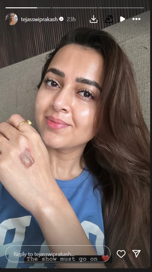 MasterChef Actress Tejasswi Prakash Suffers Injury, Says 'The Show Must Go On' 930893