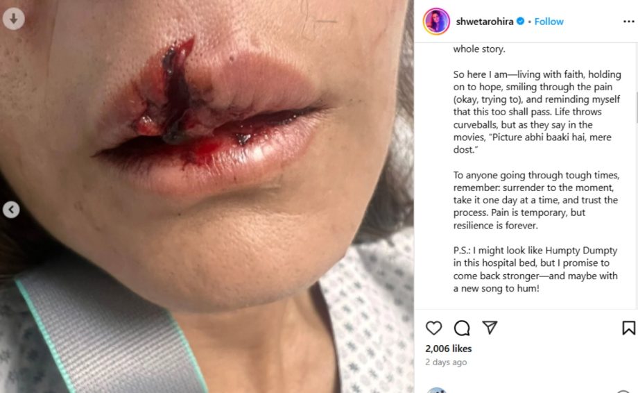 Salman Khan's Rakhi Sister and Pulkit Samrat's Ex-Wife Shweta Rohira Meets With a Horrifying Road Accident; Check Details 934891